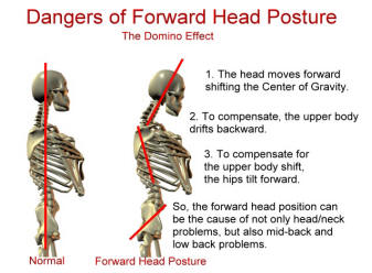 microsoft posture